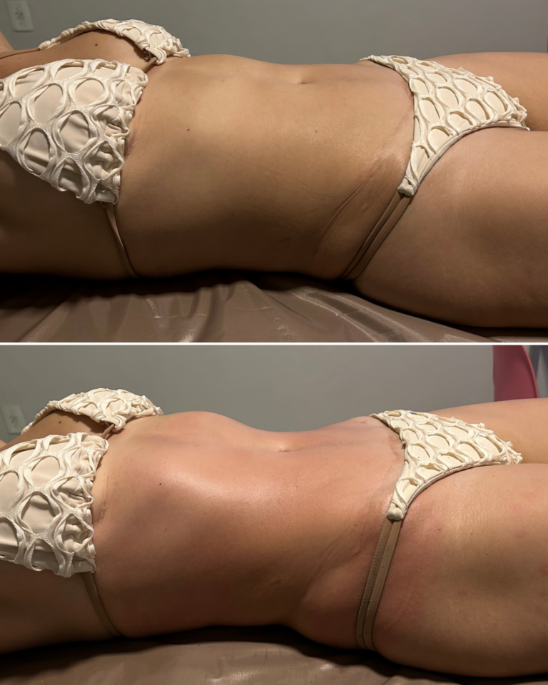 ANTES E DEPOIS JUIANA GOBBI