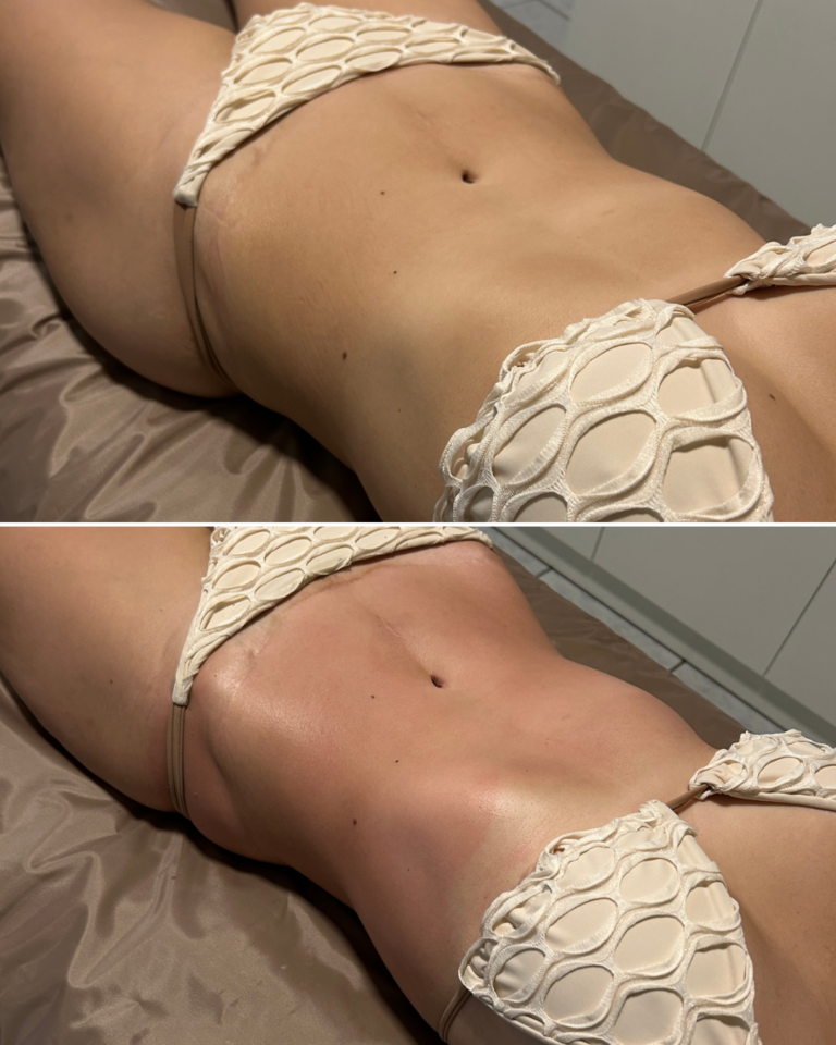 ANTES E DEPOIS JUIANA GOBBI.PNG