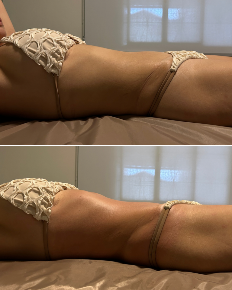 ANTES E DEPOIS JULIANA GOBBI